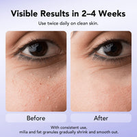 Dermea™ Milia Clear Serum