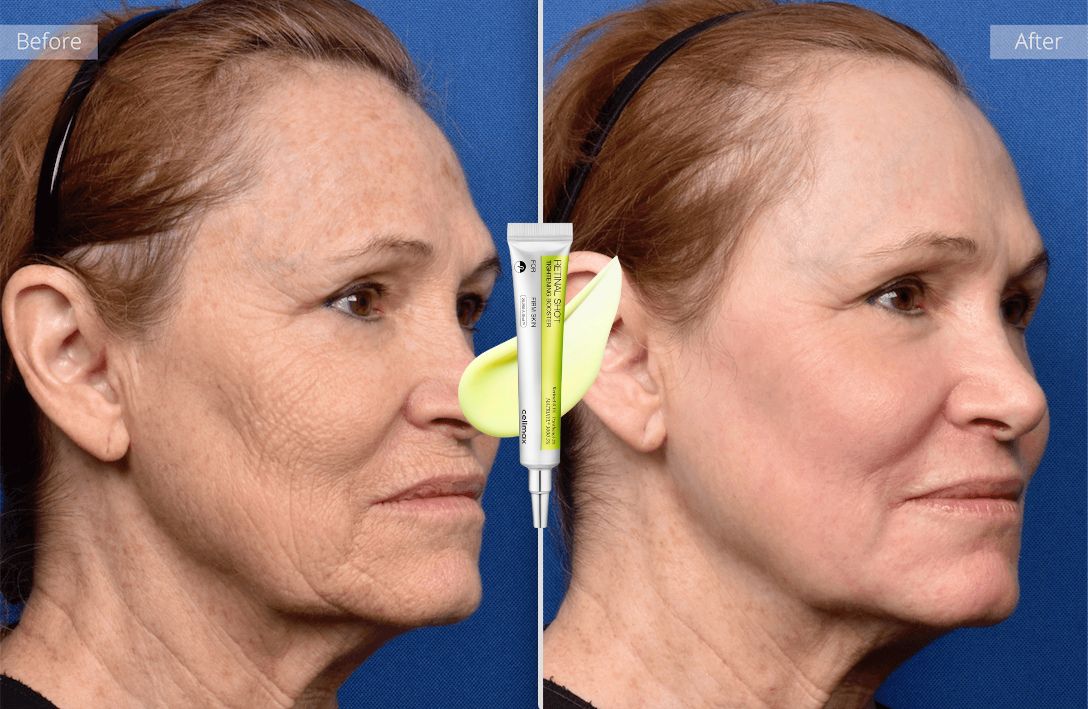 Vita A Retinal Tightening Booster™ | Selling Out Fast!